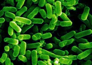 2017-04- Bazillus e.coli-ed01-425x300